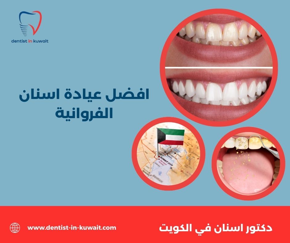 الفروانية اسنان الفروانية اسنان