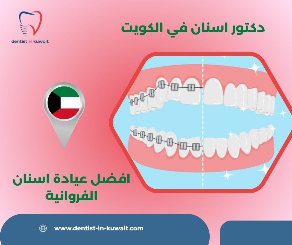 أفضل عيادة أسنان الفروانية أفضل عيادة أسنان الفروانية