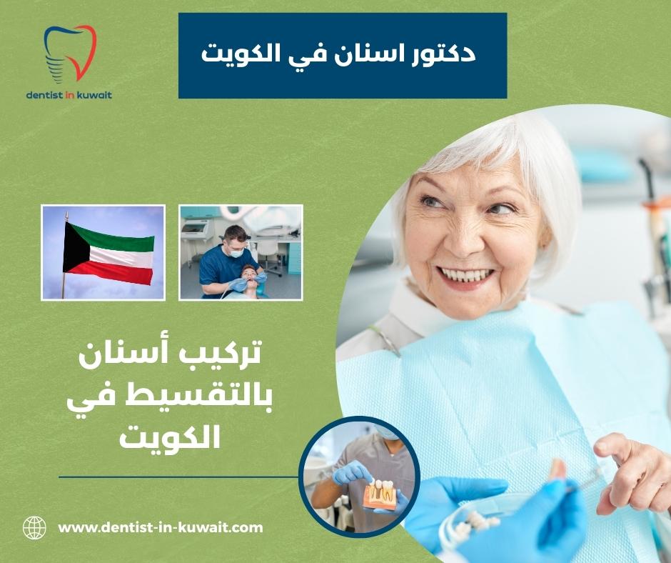 تركيب أسنان بالتقسيط في الكويت