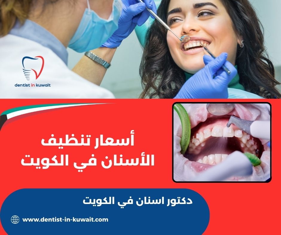 سعر تنظيف الاسنان في الكويت