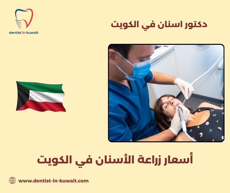 زراعة الأسنان في الكويت زراعة الأسنان في الكويت