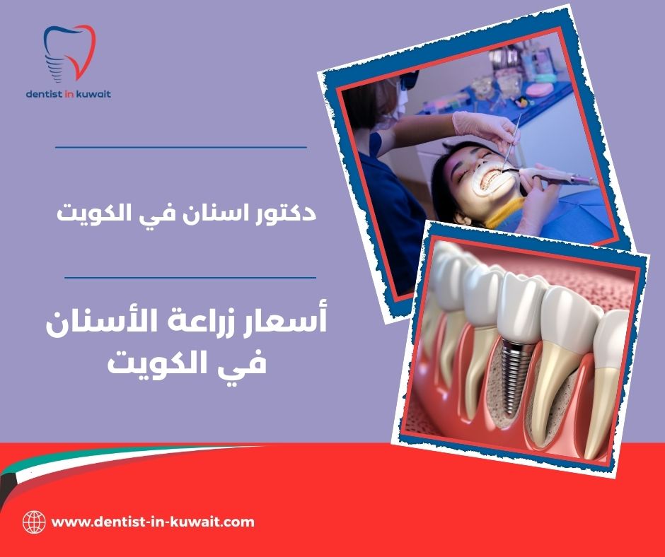 عيوب زراعة الأسنان عيوب زراعة الأسنان