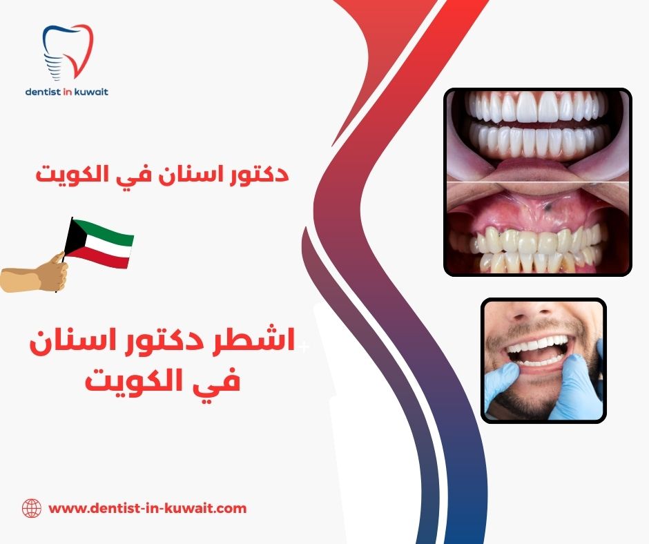 اشطر دكتور اسنان في الكويت