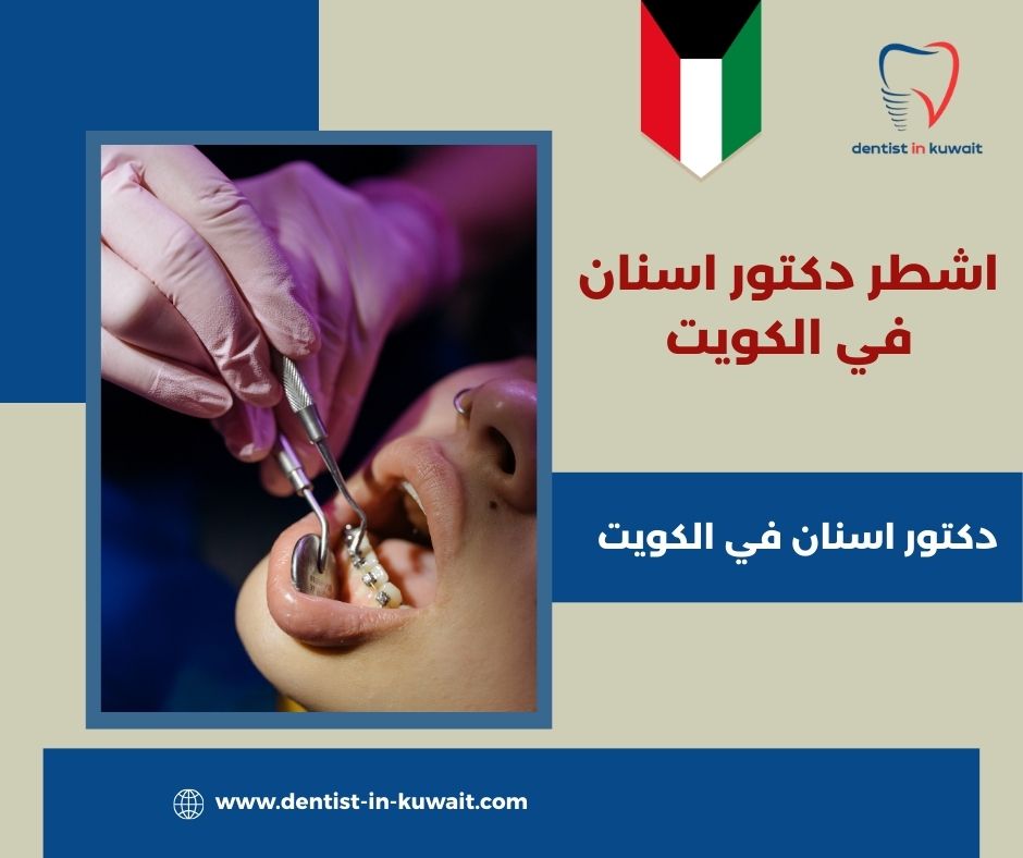 أفضل دكتور اسنان في الكويت