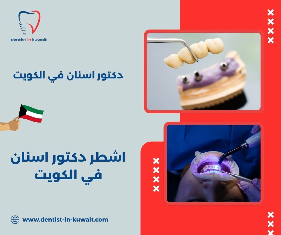 اشطر دكتور اسنان في الكويت