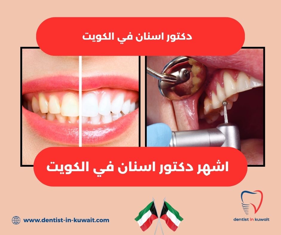 أفضل دكتور اسنان في الكويت