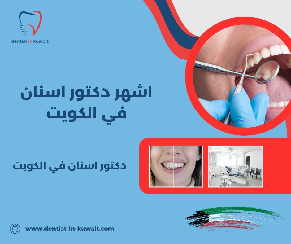 اشهر دكتور اسنان في الكويت