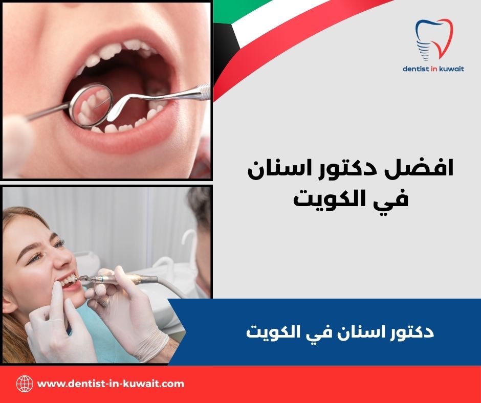 افضل دكتور اسنان في الكويت