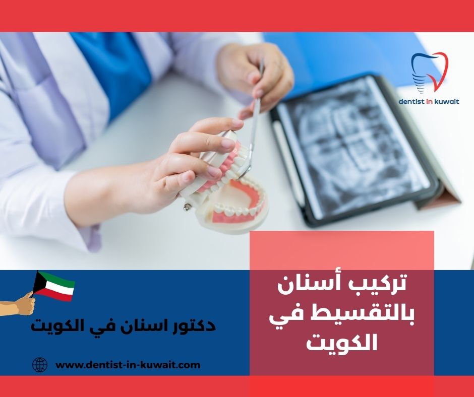عروض أسنان الكويت