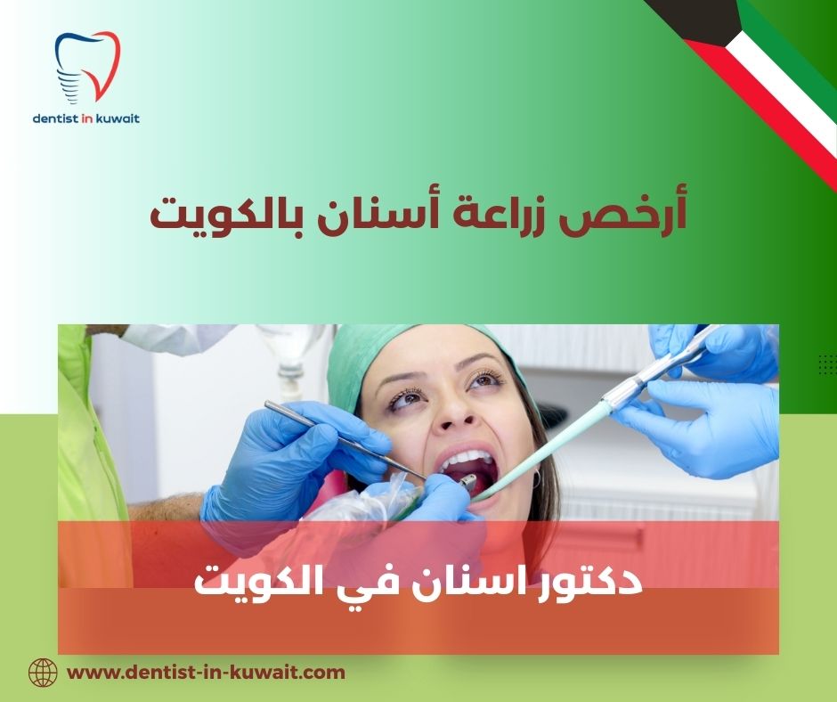 تركيب أسنان بالتقسيط في الكويت