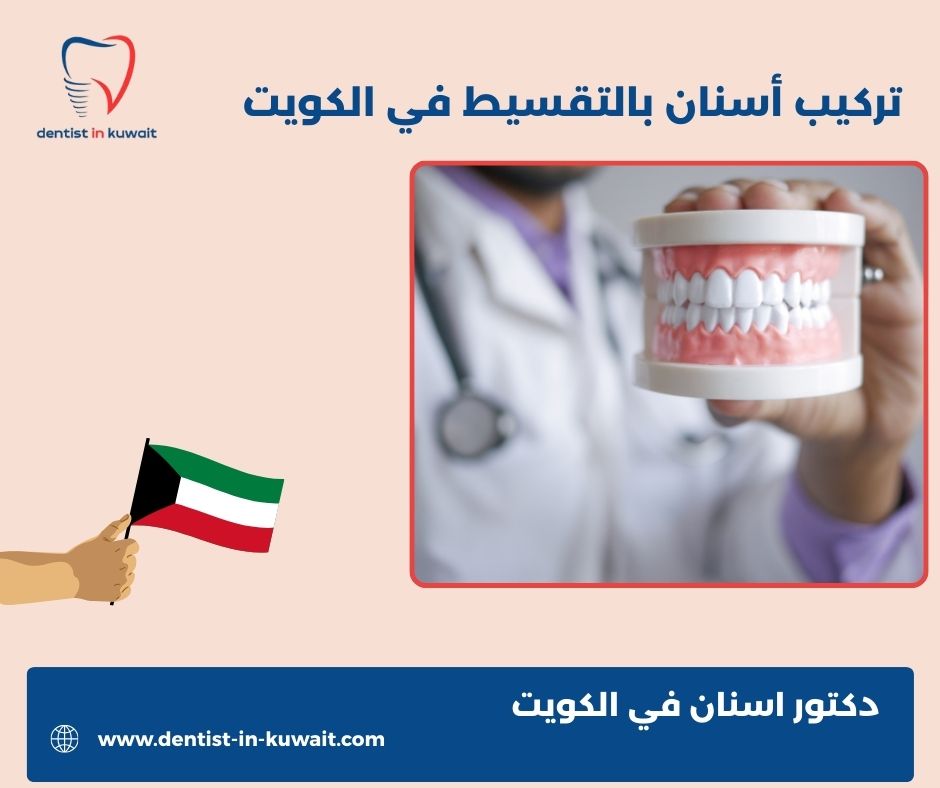 أفضل دكتور زراعة أسنان في الكويت