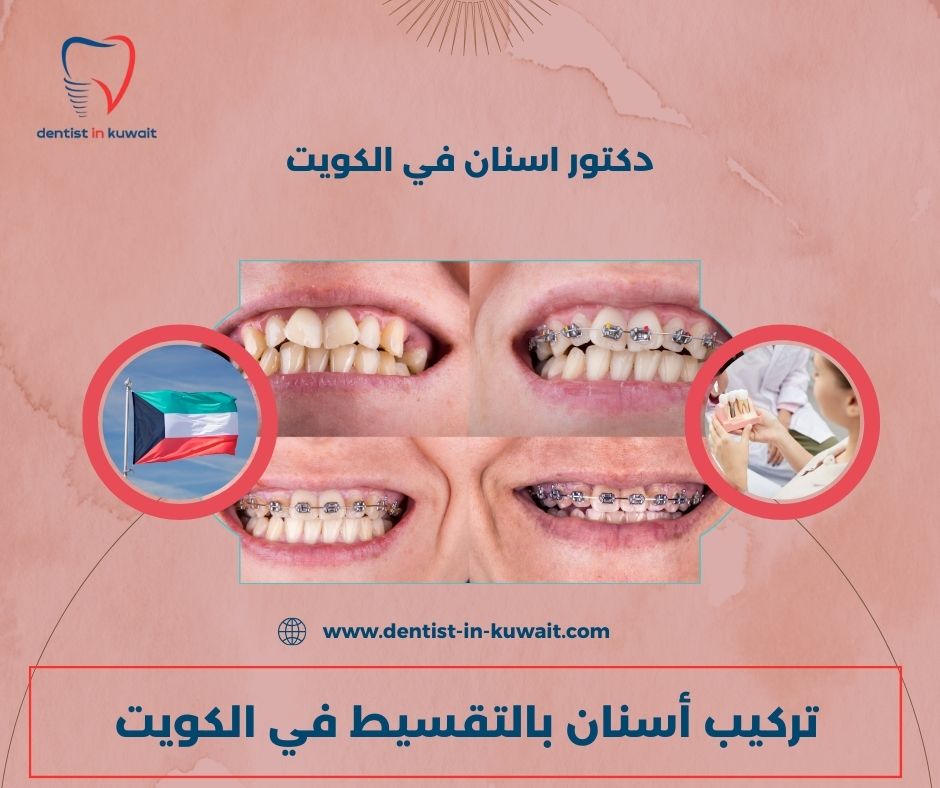 أسعار عيادات الأسنان في الكويت