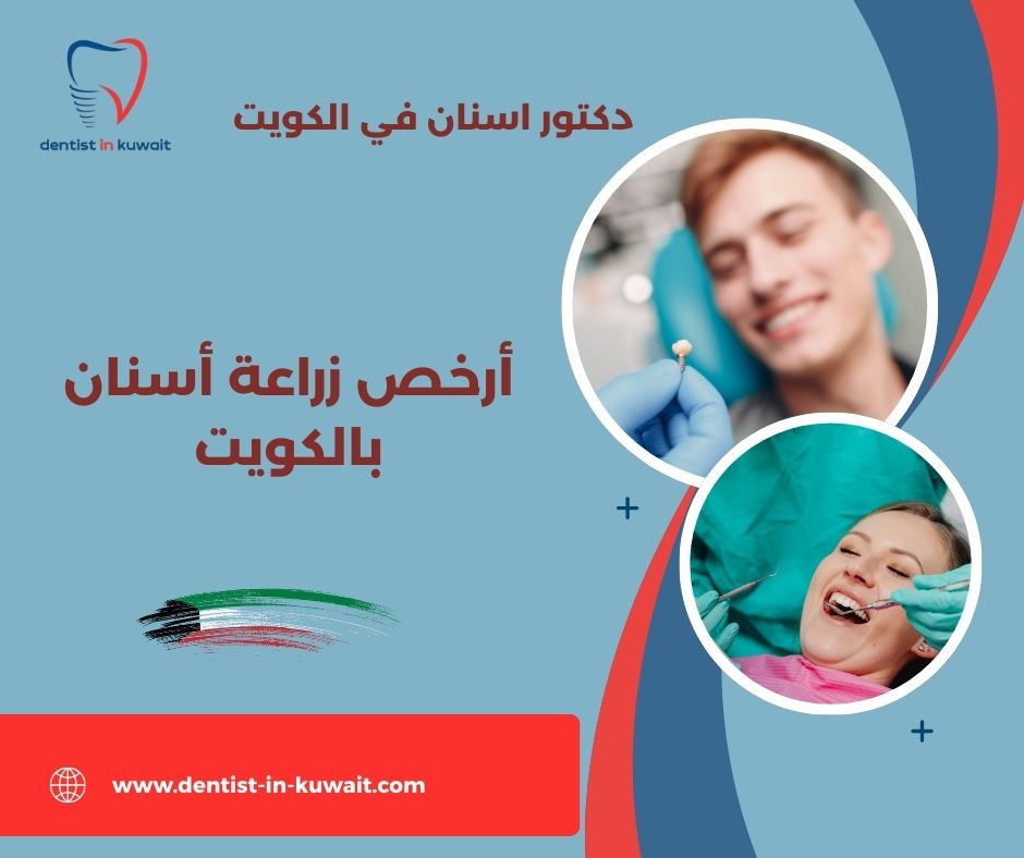 أفضل دكتور زراعة أسنان في الكويت