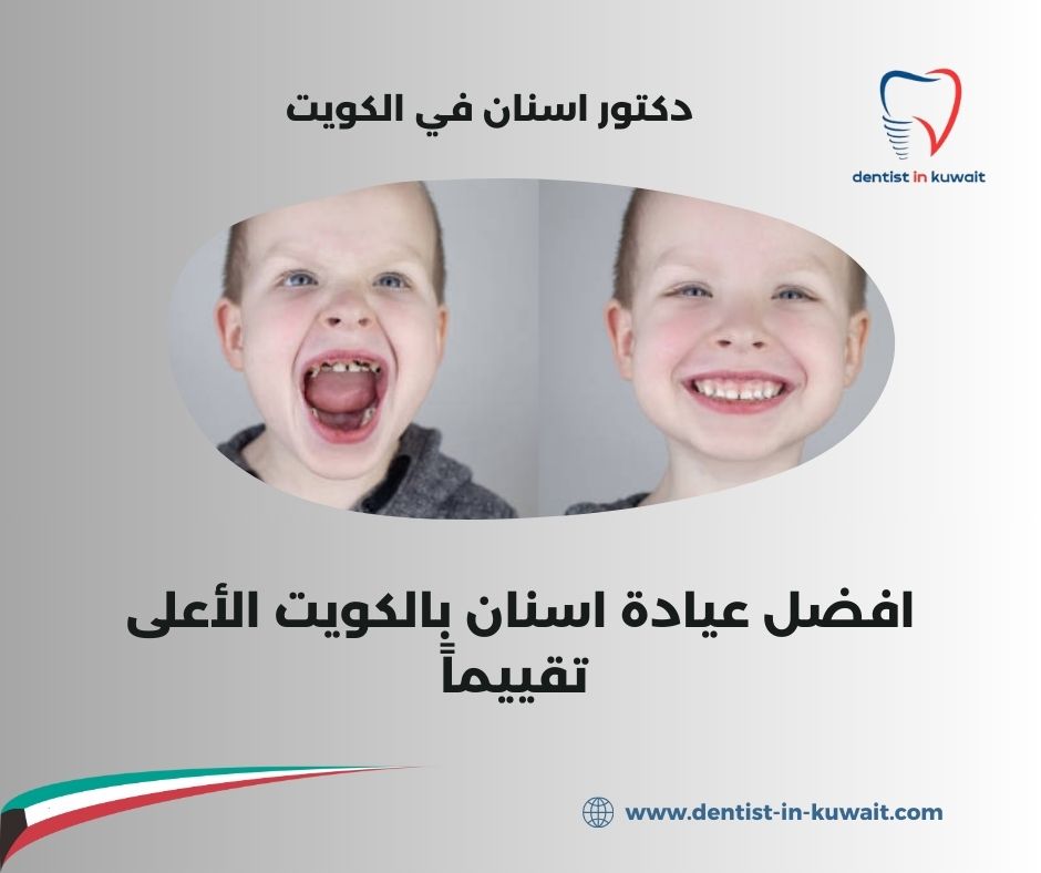 افضل عيادة اسنان بالكويت رخيصه