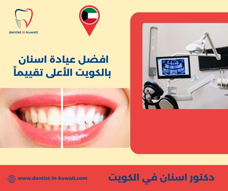 افضل عيادة اسنان بالكويت الأعلى تقييماً