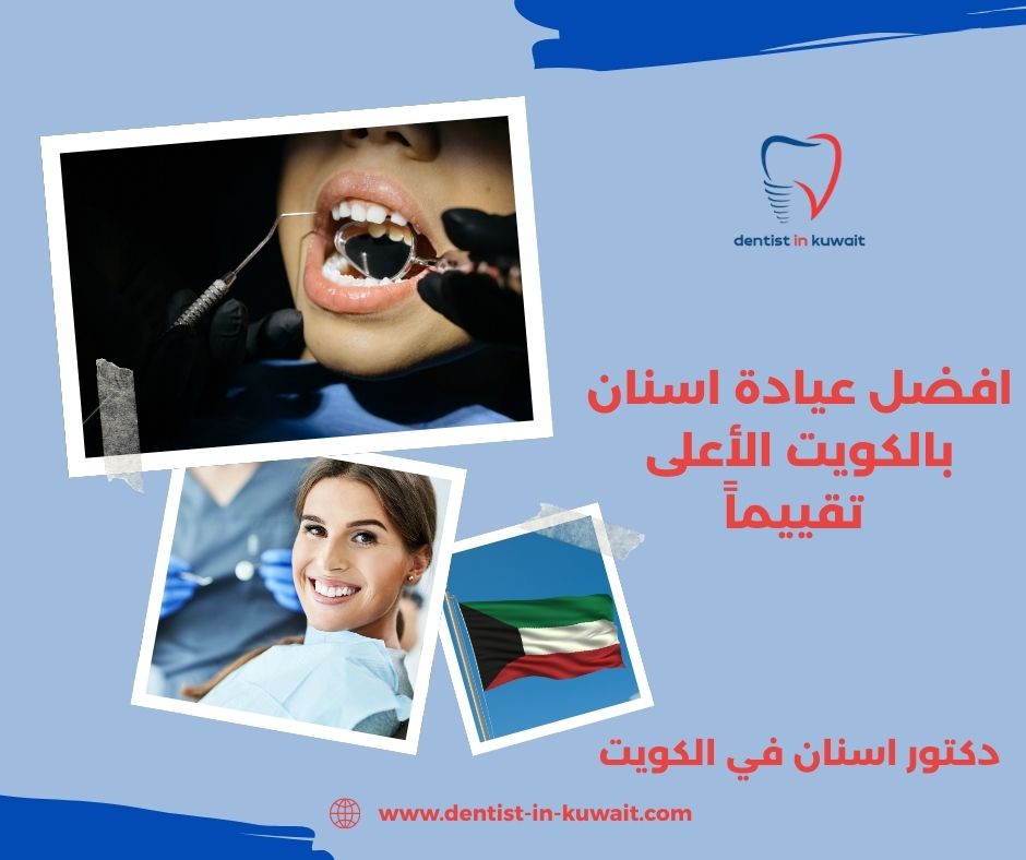 افضل عيادة اسنان بالكويت الأعلى تقييماً