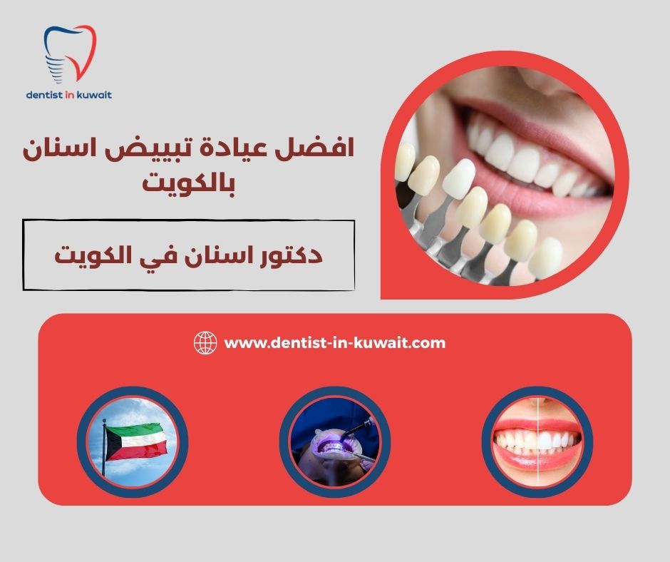 افضل عيادة تبييض اسنان بالكويت