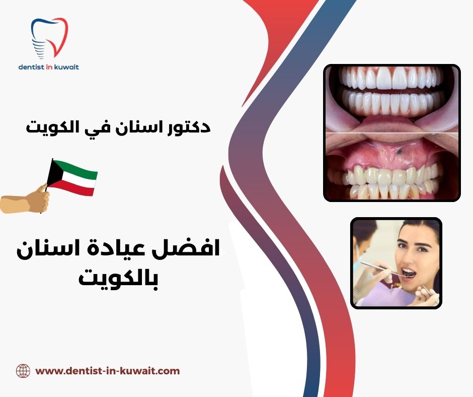 افضل عيادة اسنان بالكويت رخيصه