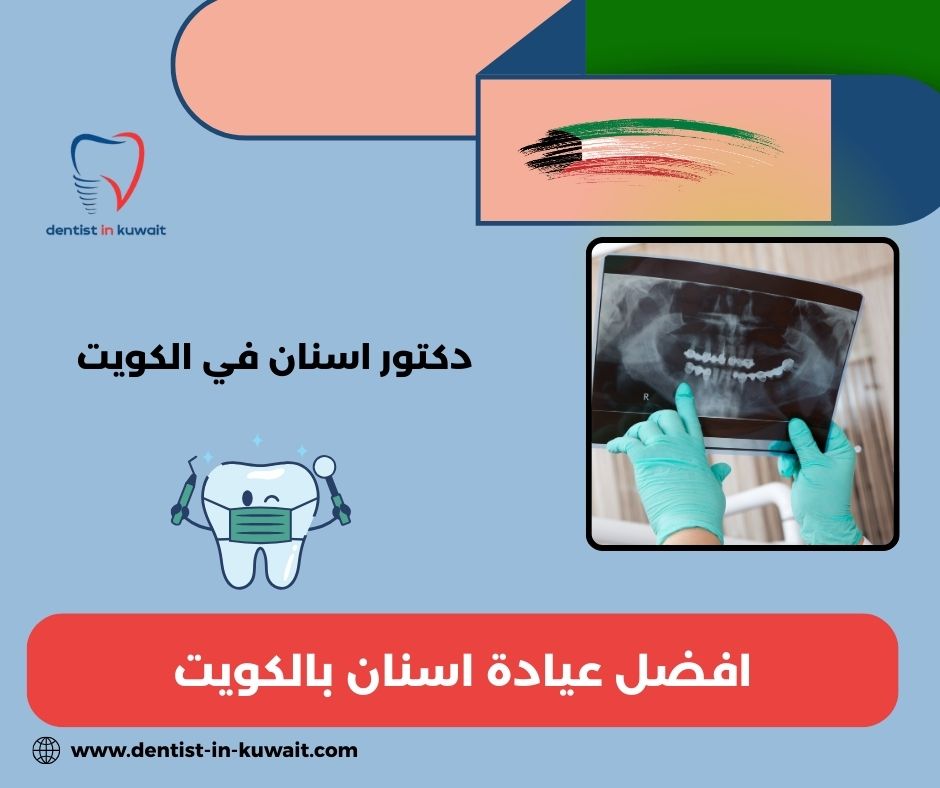 افضل عيادة اسنان الكويت