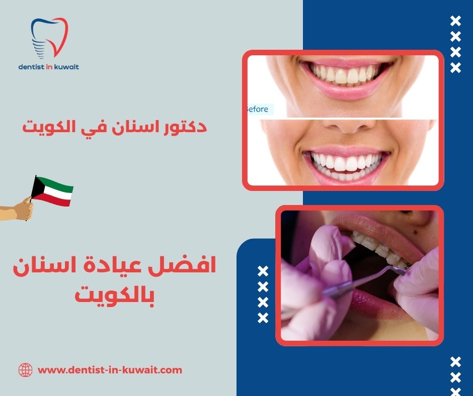 افضل عيادة اسنان بالكويت