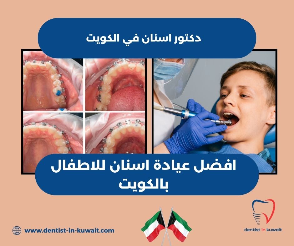 افضل عيادة اسنان للاطفال بالكويت