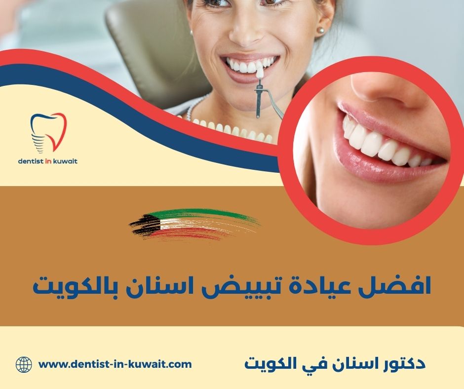 تبييض اسنان الكويت