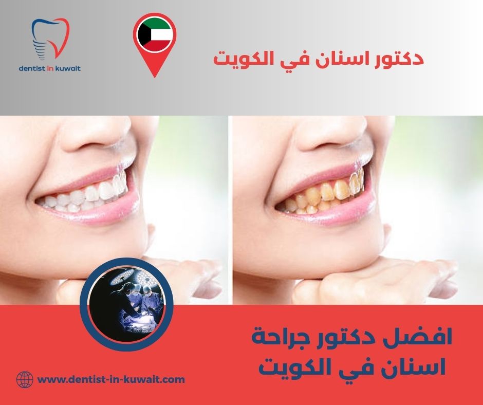 افضل دكتور جراحة اسنان في الكويت