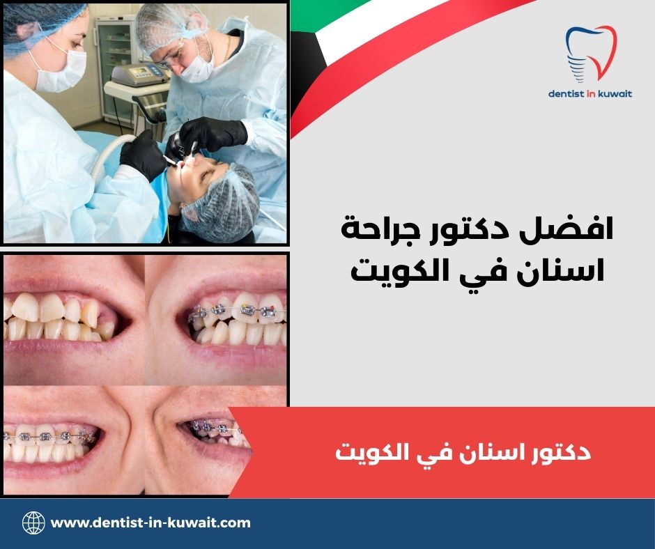 افضل دكتور اسنان في الكويت