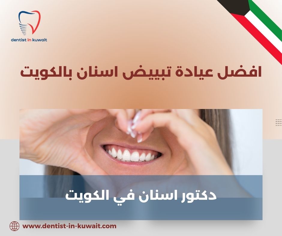 تبييض الاسنان في الكويت