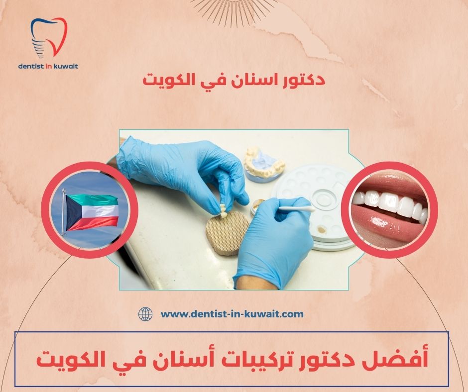 أفضل دكتور تركيبات أسنان في الكويت