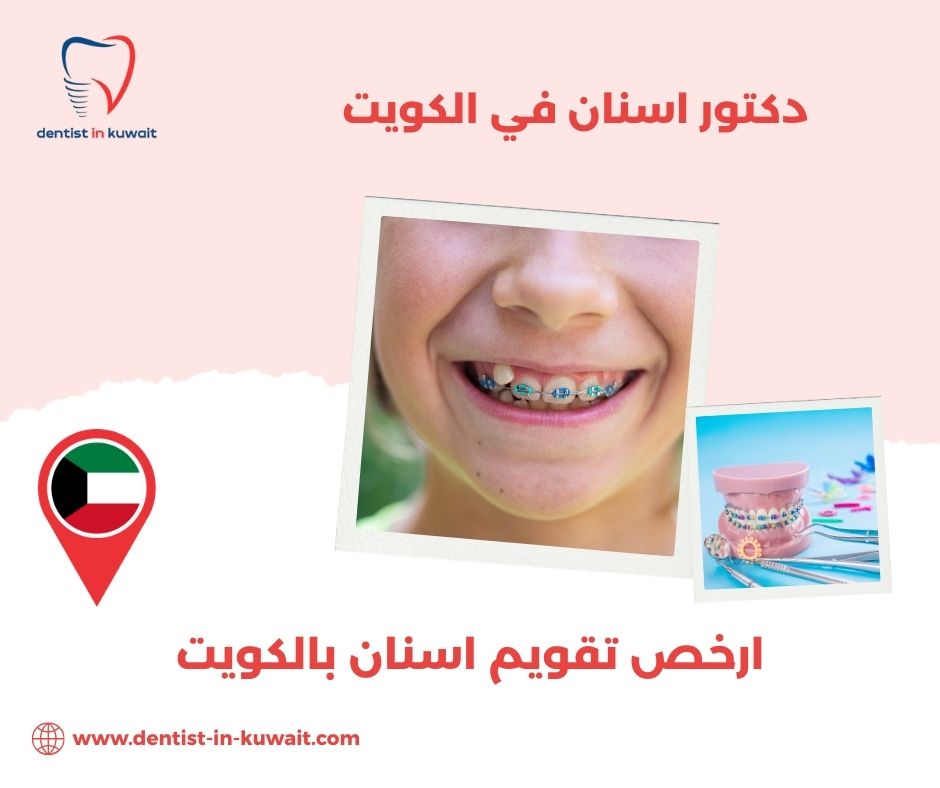 ارخص عيادة اسنان بالكويت