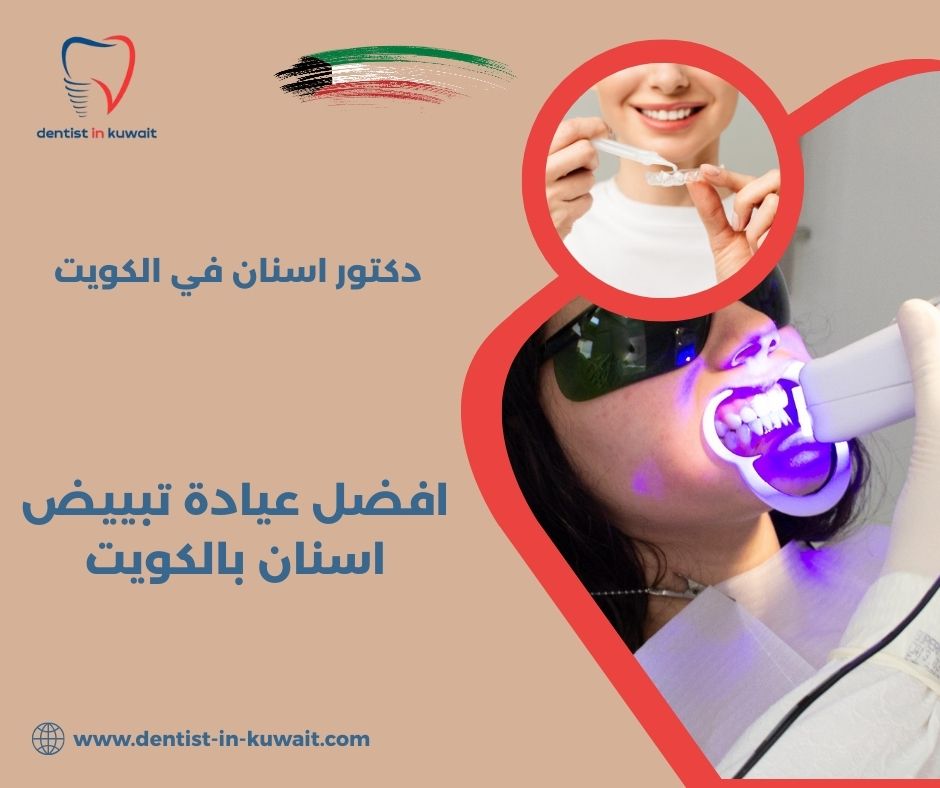 سعر تبييض الاسنان في الكويت