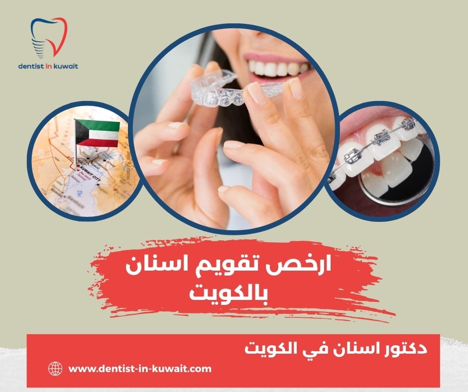 ارخص تقويم اسنان بالكويت