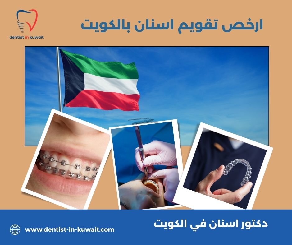 أسعار تقويم الاسنان في الكويت