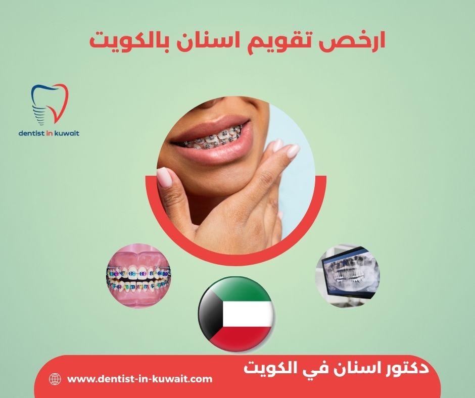أسعار عيادات الأسنان في الكويت.