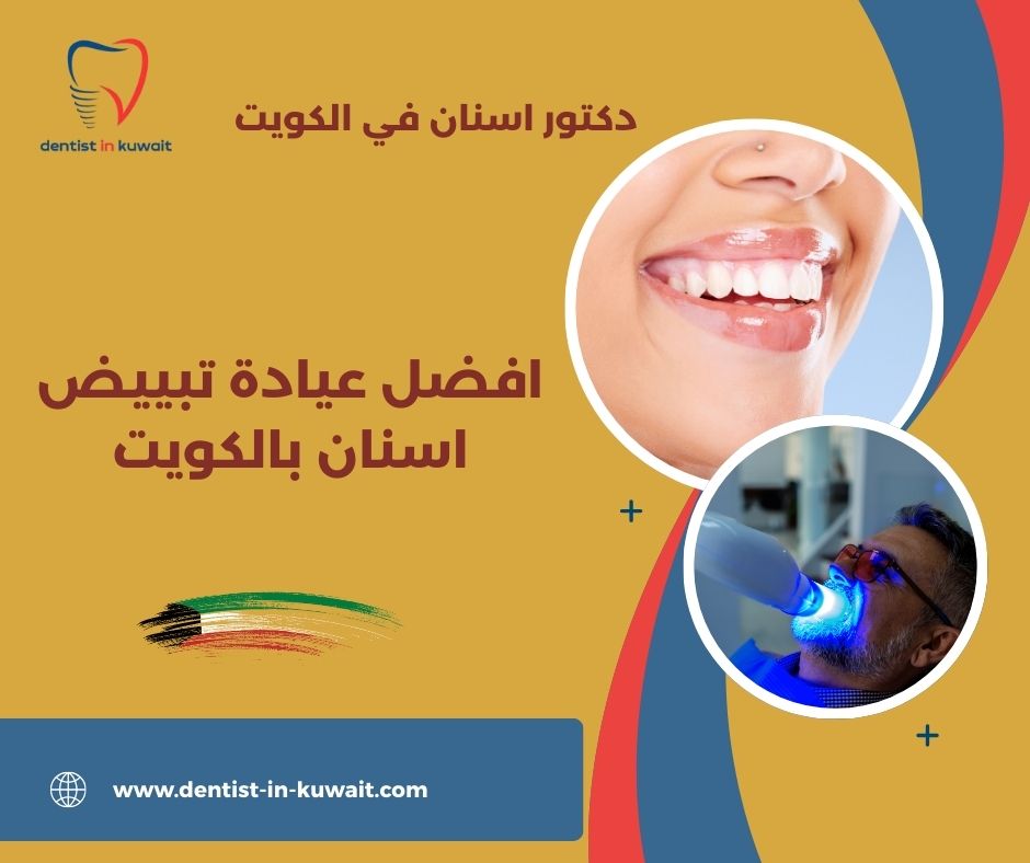 اسعار تبييض الاسنان في الكويت