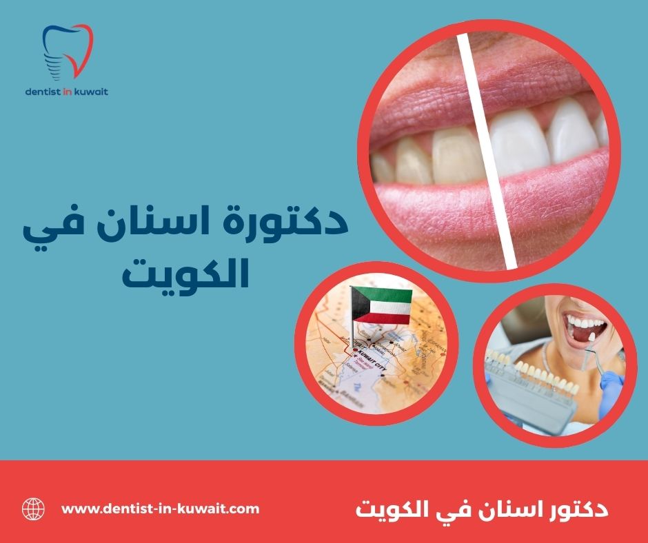 دكتورة اسنان في الكويت