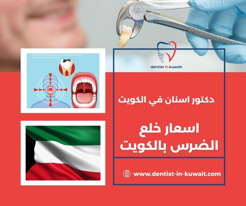 طريقة خلع الاسنان في البيت طريقة خلع الاسنان في البيت