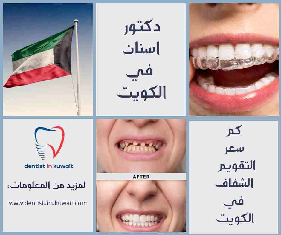 كم سعر التقويم الشفاف في الكويت