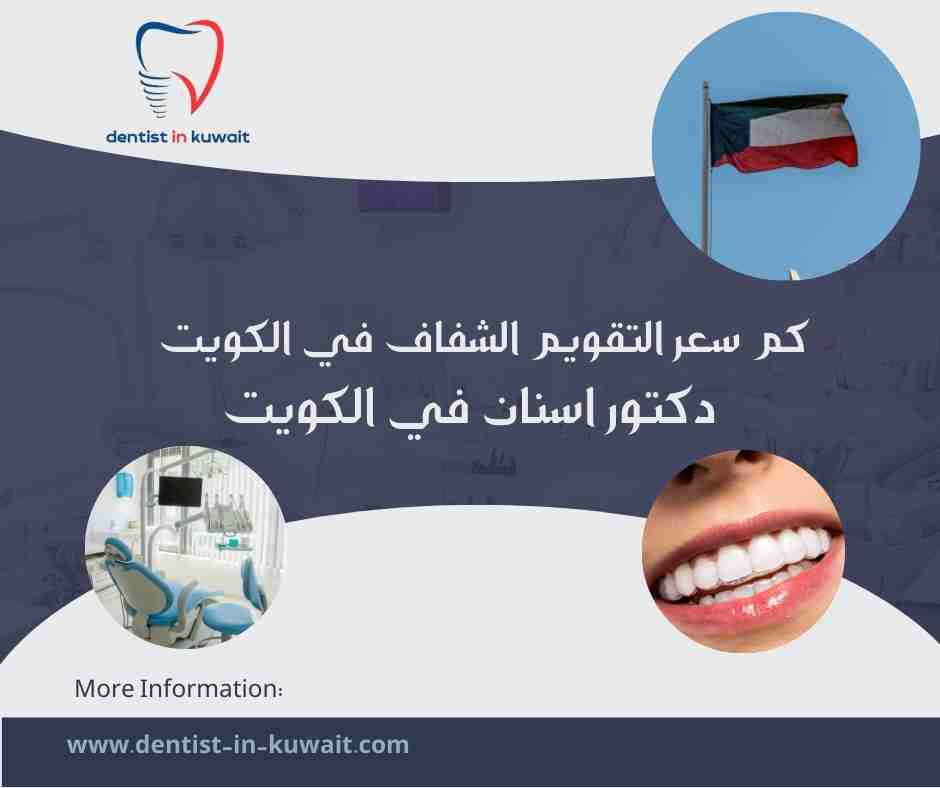 كم سعر التقويم الشفاف في الكويت