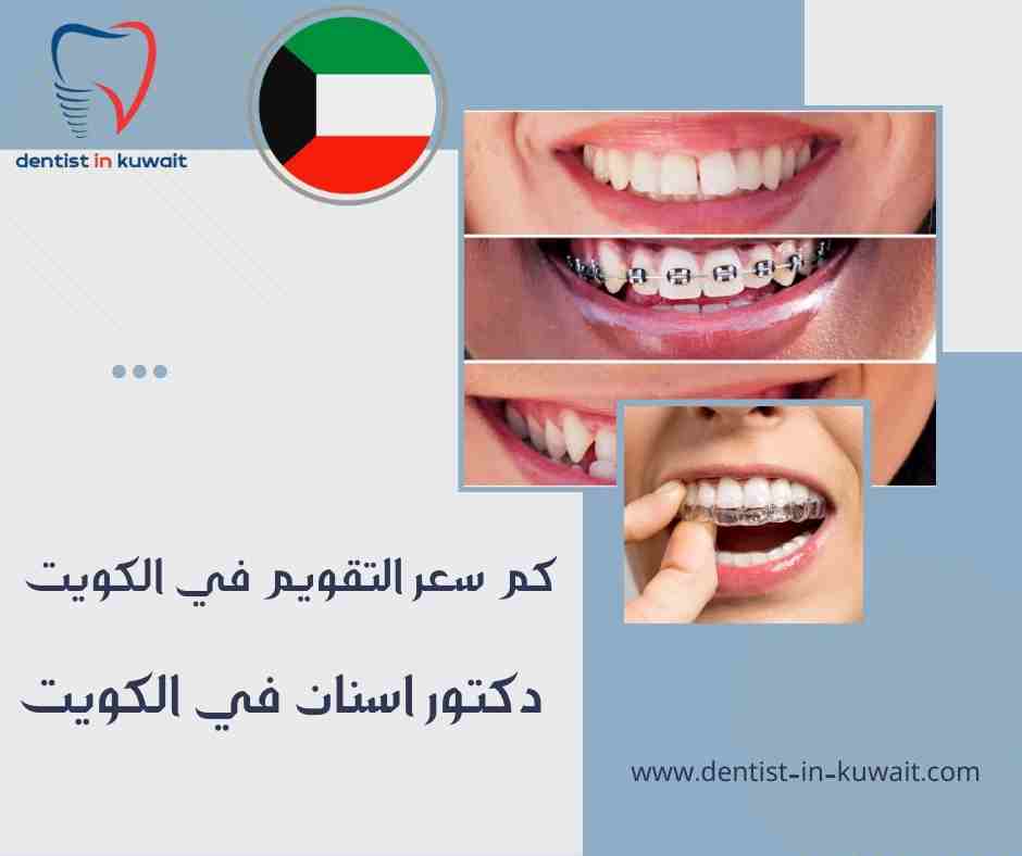 كم سعر التقويم في الكويت