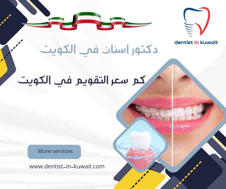 كم سعر التقويم في الكويت