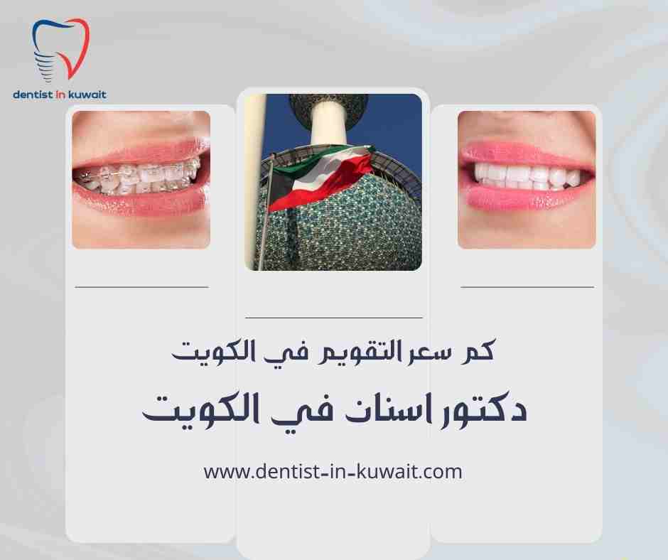 كم سعر التقويم في الكويت