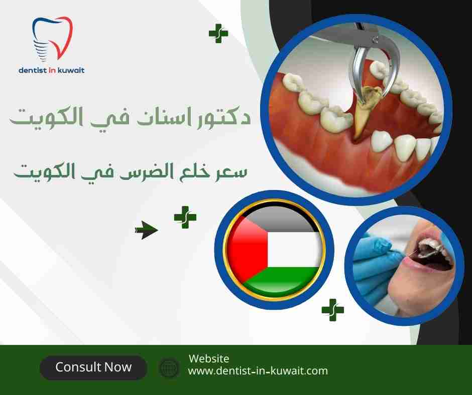سعر خلع الضرس في الكويت