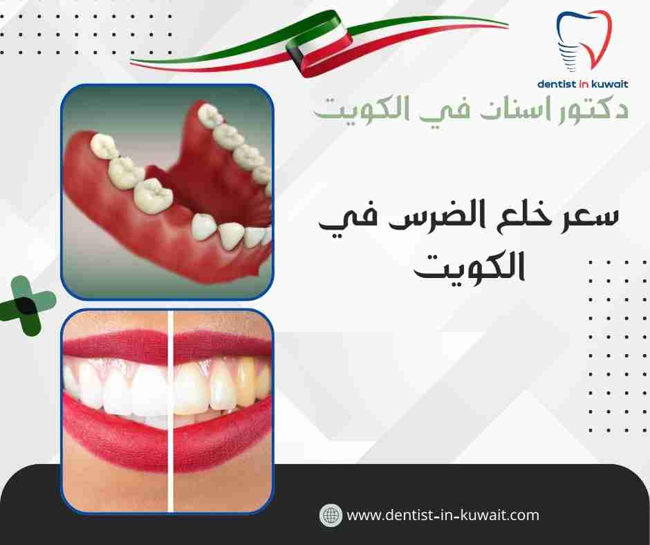 سعر خلع الضرس في الكويت