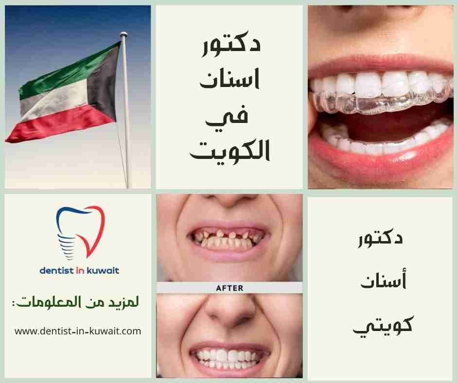 دكتور أسنان كويتي