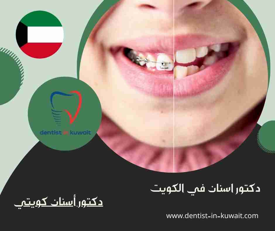 دكتور أسنان كويتي