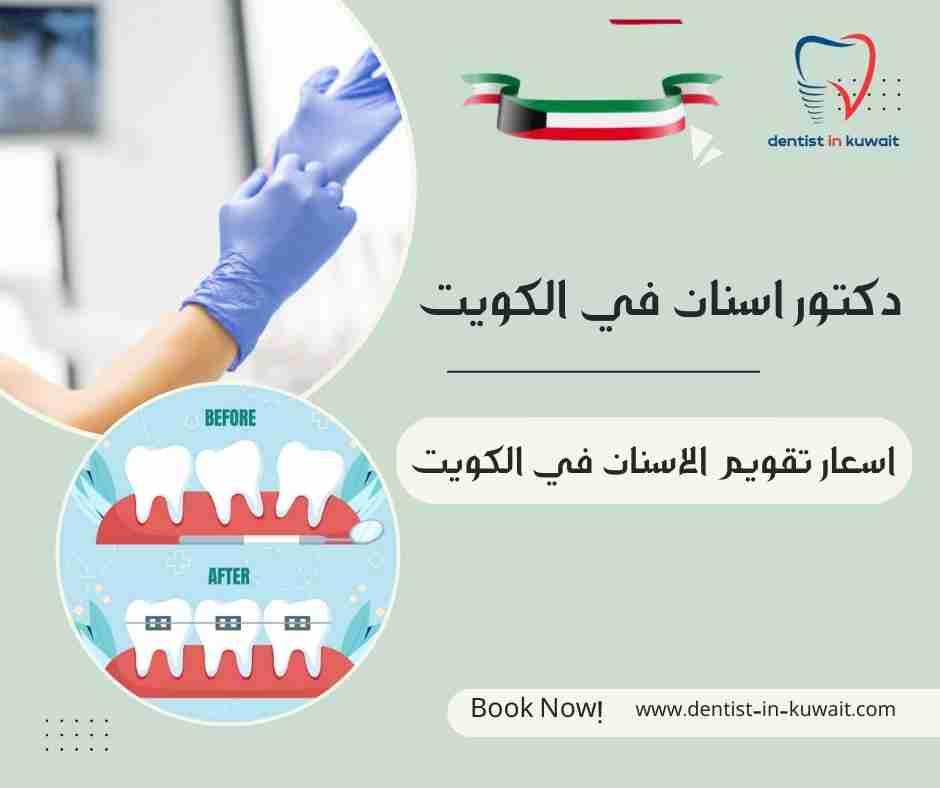 اسعار تقويم الاسنان في الكويت