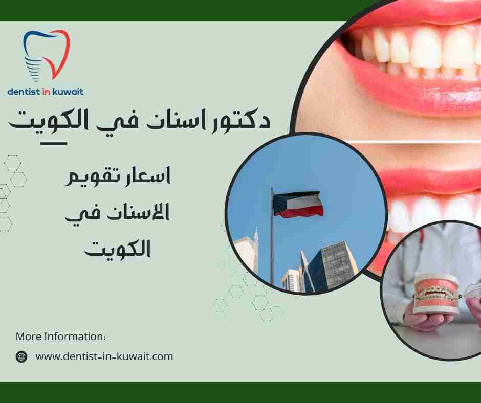 اسعار تقويم الاسنان في الكويت