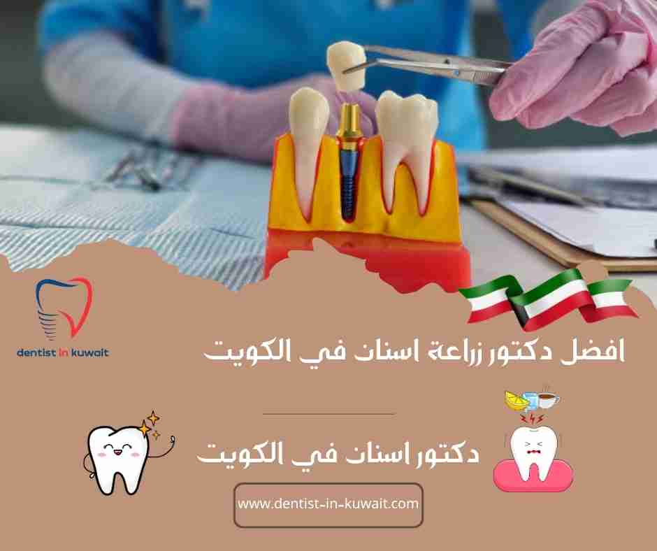 افضل دكتور زراعة اسنان في الكويت